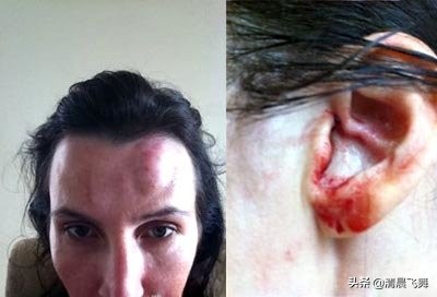 在孩子面前家暴的危害,家暴对家庭有什么危害