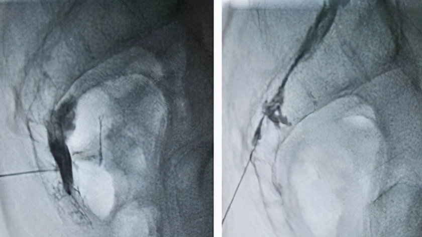 疑难杂症1针见效,疑难疼痛诊疗