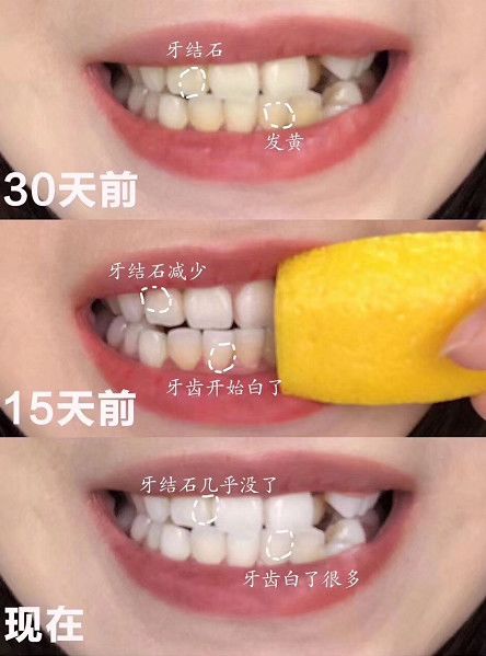 李佳琦一月变白秘籍,李佳琦的正确刷牙方法视频
