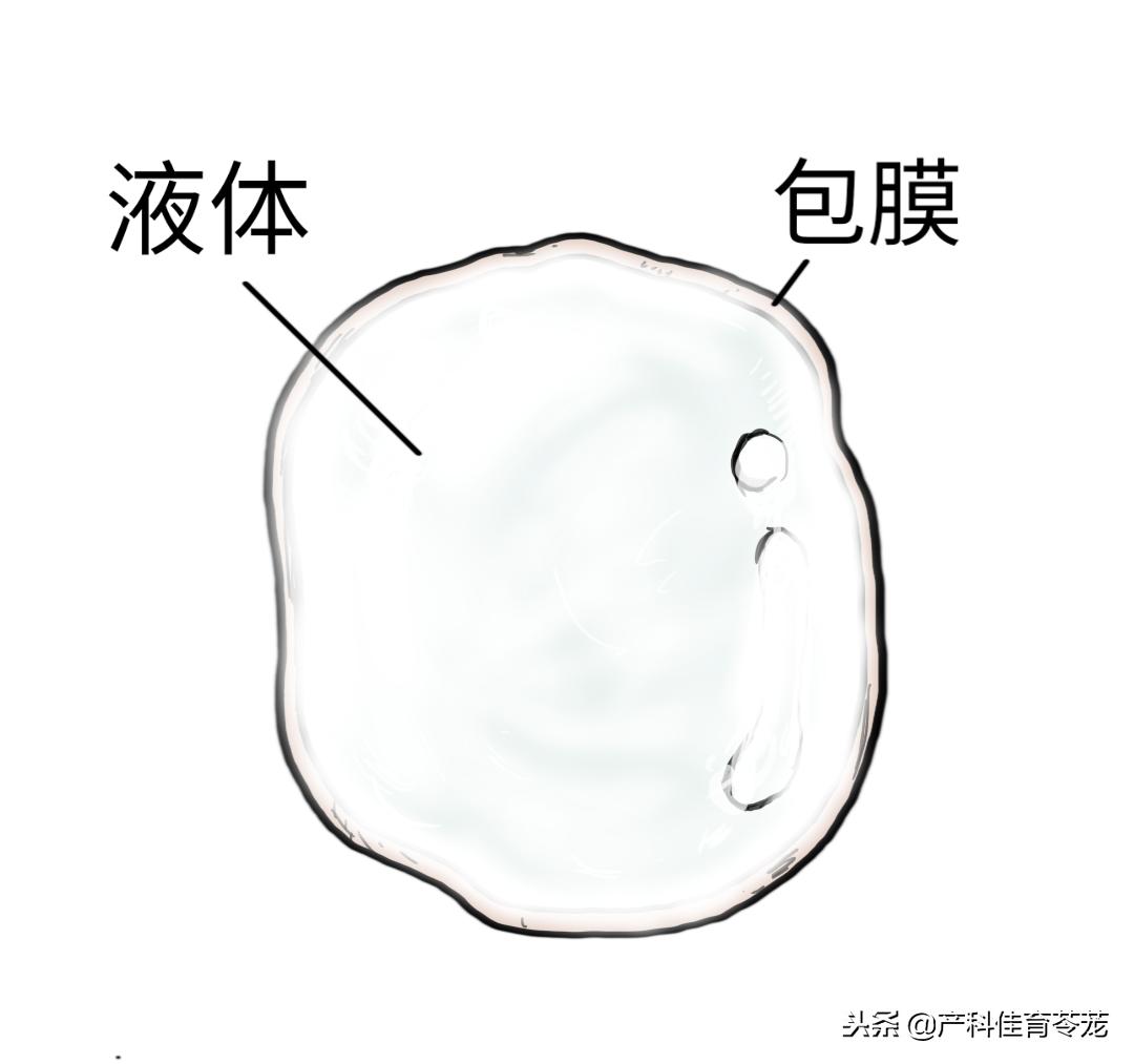 卵巢囊肿是黄体囊肿吗,盆腔囊肿是卵巢囊肿吗