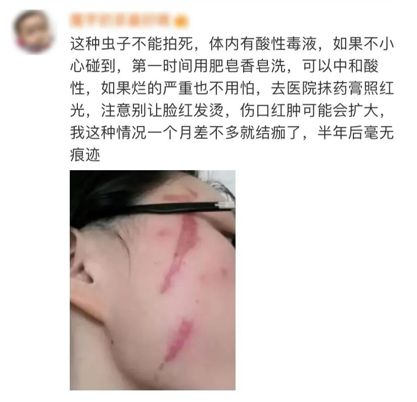 熬夜玩手机女性危害,女生熬夜玩手机导致失明