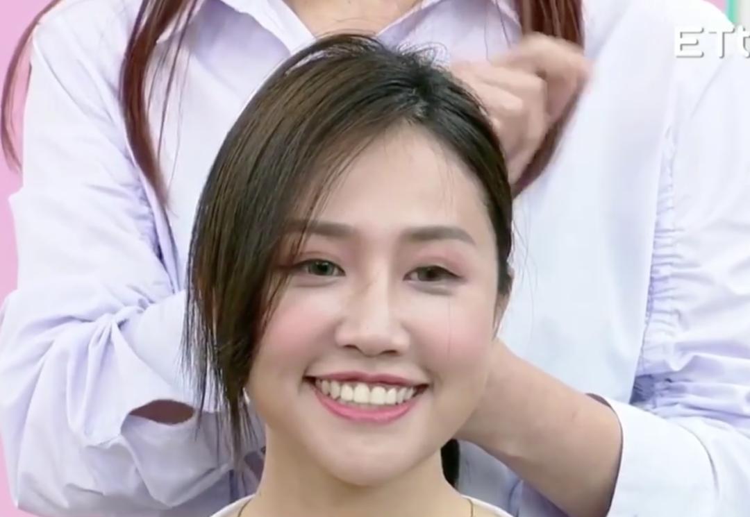 头发秃发量少该怎么拯救,头发秃扁怎么办小妙招