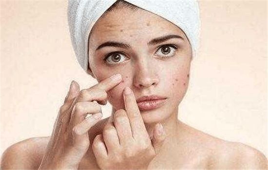 胸口周围发黑怎么办,胸口发黑起皮怎么回事