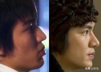 盘点整容后不敢认的女星颜值巅峰,知名女网红被扒整容