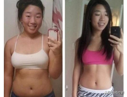 又胖又丑，还有必要减肥吗？你怎么看？