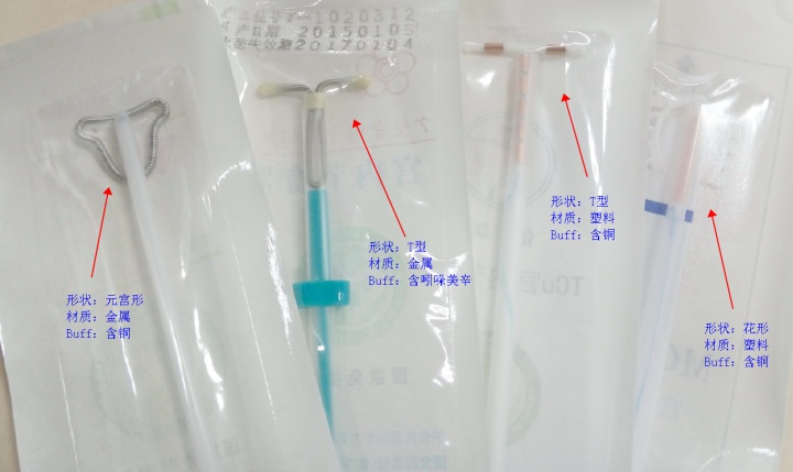 宫内节育器和节育环有什么区别,宫内节育器避孕环