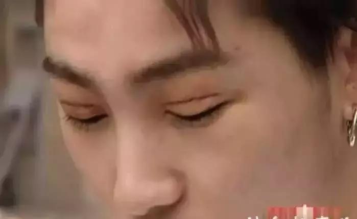 男生割内双眼皮手术,男子去割单眼皮后的结果