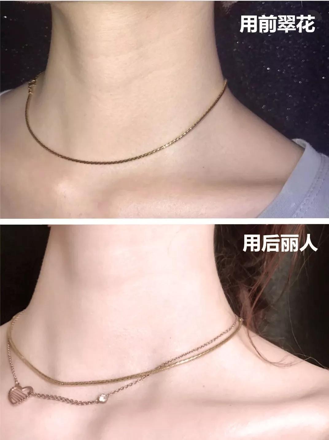 怎么变白又快又有效不花一分钱,最有效的变白方法学生党