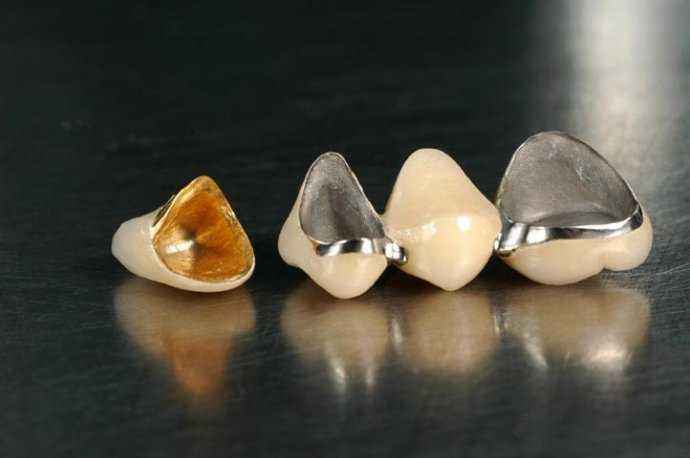 烤瓷牙崩瓷的正确处理方法,烤瓷牙崩瓷了怎么修