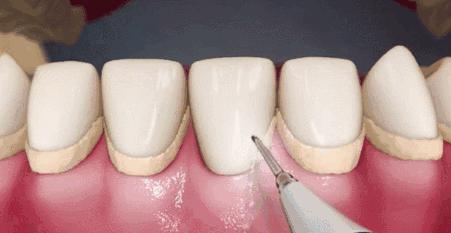 Helen榻跨涓績,helen鍙ｈ厰