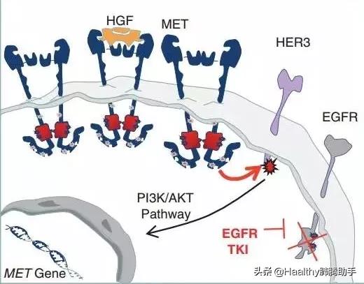靶向治疗耐药后怎么办,肺癌靶向药如何延缓耐药