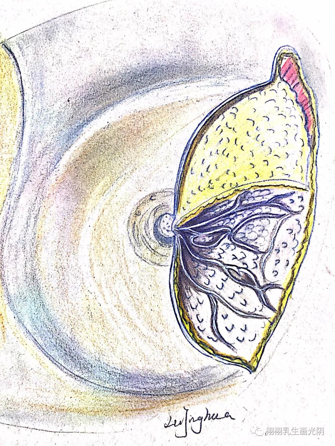 良性乳腺肿瘤要切除吗,乳腺良性病变可能性大