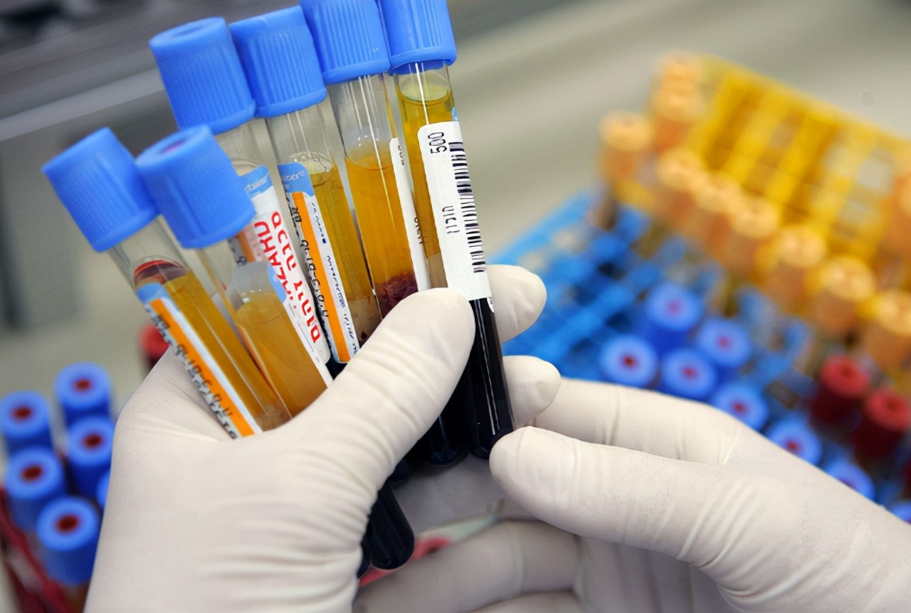 a型b型ab型o型哪种血型体质最好,a型b型ab型和o型哪种血型最好