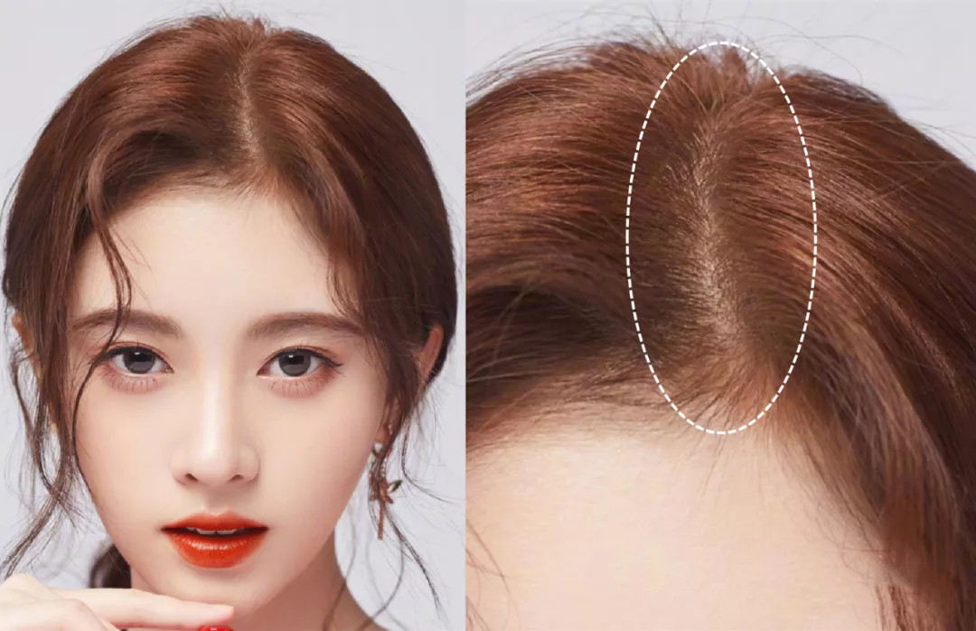 发量少有什么小妙招,发量少发型简单好看教程