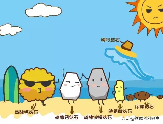 尿结石的自白书：想赶我走？让我来给你指条明路