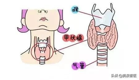 体检查出甲状腺结节该咋办,体检有甲状腺结节医生说没事