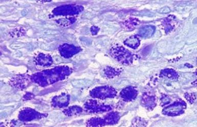 关于EGC身为铲屎官的你知多少？各种皮肤病都可能是EGC！