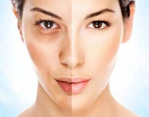 去角质搓出来的泥代表什么,去角质搓下来的真的是角质吗