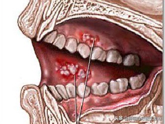 肿瘤医生最常问的问题,癌症重要的早期预警信号