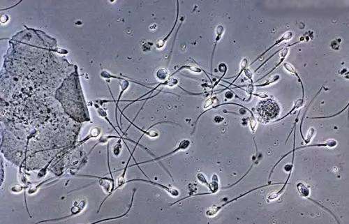 精液里面有果冻块是不是精液不液化？