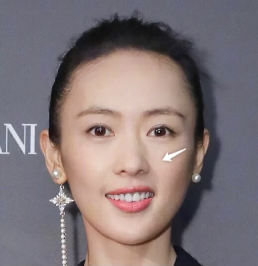 大小脸改善大方脸,大小脸是改善大脸还是改善小脸