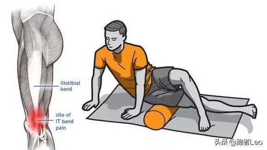 有被髂胫束综合症困扰的吗,髂胫束综合征如何快速好起来
