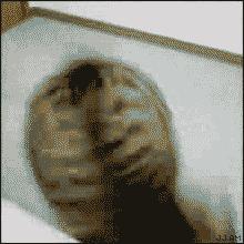 头皮瘙痒头屑多脱发严重,冬季头皮干燥头屑多怎么办