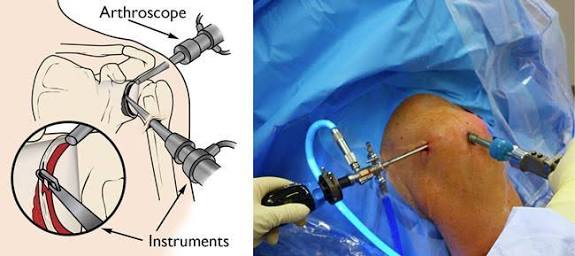肩膀疼痛要警惕的三种病怎么治疗,肩膀疼痛要警惕的病怎么治疗