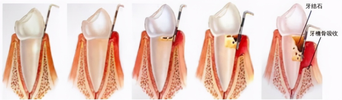 雅悦齿科,牙齿矫正雅悦齿科