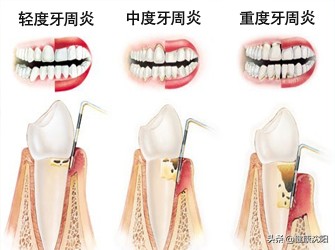 健康科普堂,健康科普堂养生
