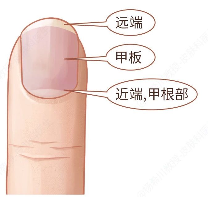 小小的指甲隐藏大大的健康秘密,小小指甲大调查