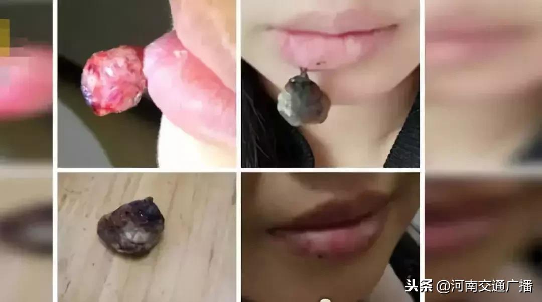 孕妇嘴唇干裂脱皮痛怎么办,孕妇嘴唇干裂脱皮没有口红怎么办