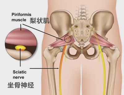 腰椎间盘轻度膨出怎么症状挺严重,腰椎间盘轻度膨出有什么症状
