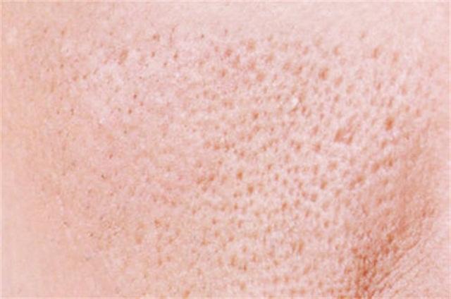 毛孔粗大怎么办最有效收缩毛孔,毛孔粗大怎么办怎么有效收缩毛孔