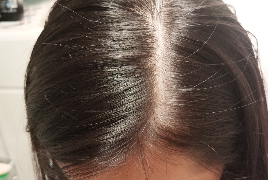 比较好用的德国防脱发,德国十大最好用的护肤品