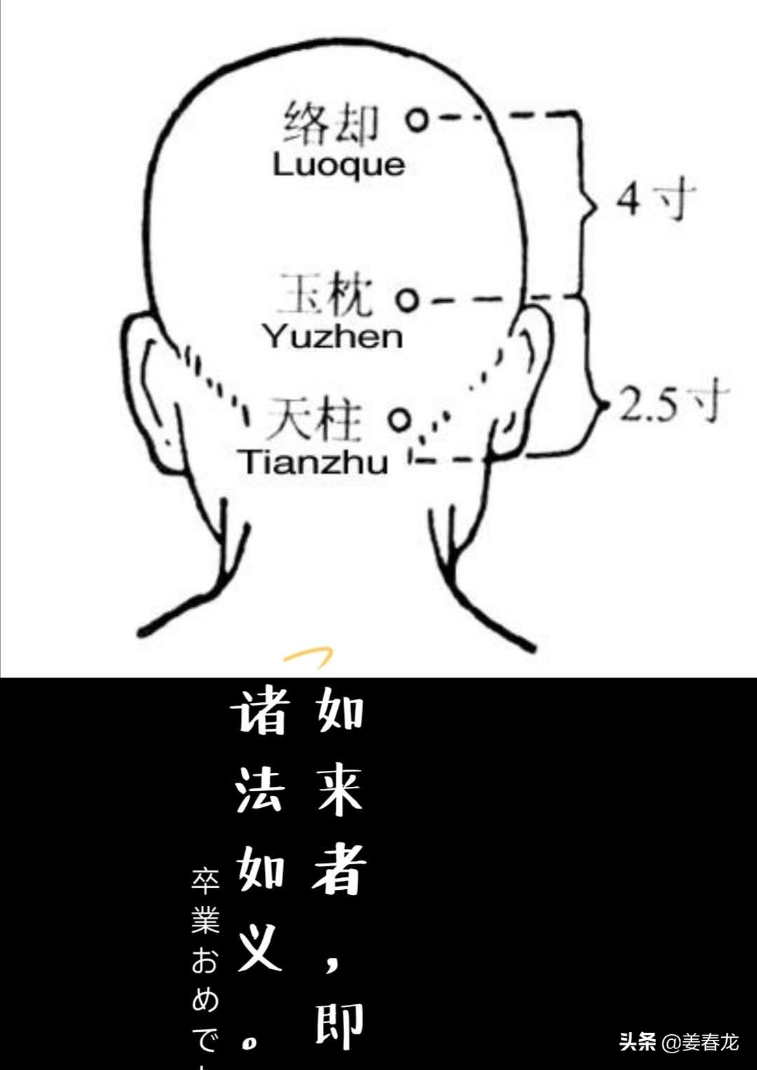 落枕左天柱穴痛,天柱穴风池穴酸胀