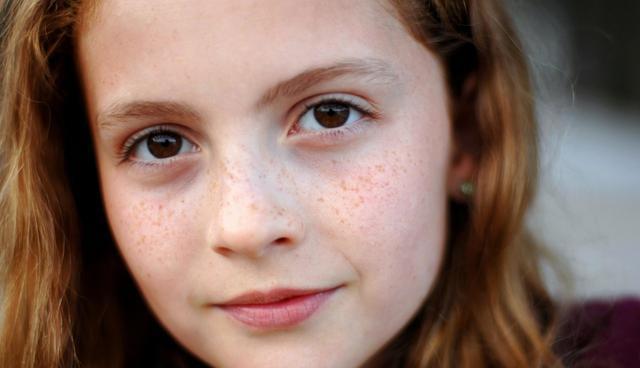 雀斑祛斑最简单有效方法,雀斑祛斑最有效方法真实测评