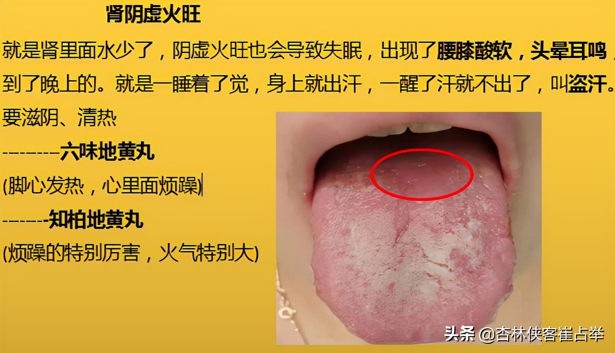 治疗失眠什么中成药效果好,治疗失眠中成药大总结