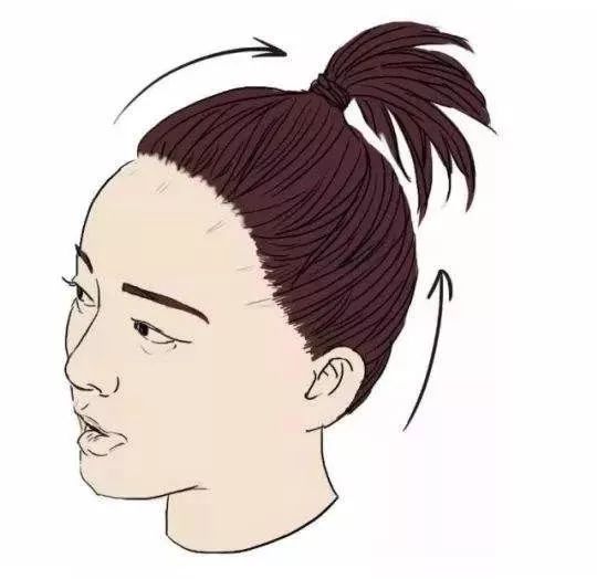 女的发际线后移的原因中医,女性脱发严重发际线后移