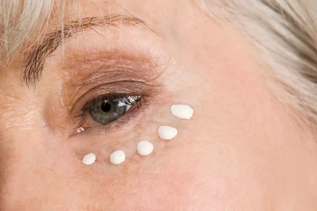 与脂肪粒和解要做好以下几点,处理隐蔽脂肪粒