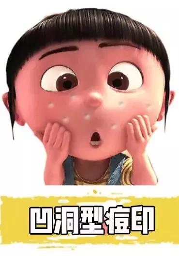 女生爆痘必买清单药膏,战痘用什么祛痘最好