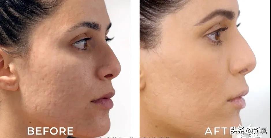 刘诗诗最近生图,刘诗诗旧照脸又胖又大