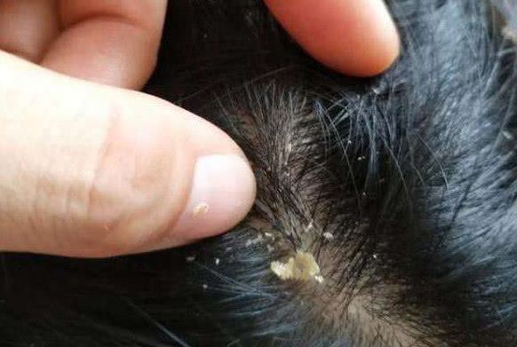 头发2天不洗就油是怎么回事,头发2天不洗头痒怎么回事