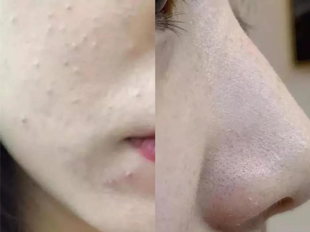 快用完的洗面奶,真正有效的清洁毛孔的洗面奶