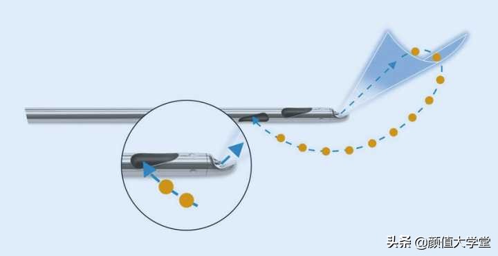 抽脂和吸脂后有什么注意事项,吸脂手术的危害和后遗症
