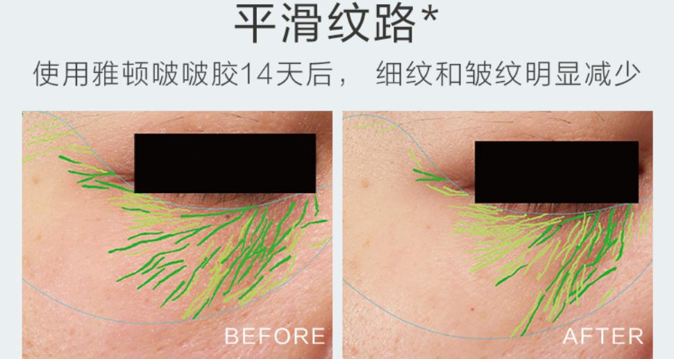 雅顿啵啵胶怎么使用,雅顿啵啵胶和粉胶价格差多少