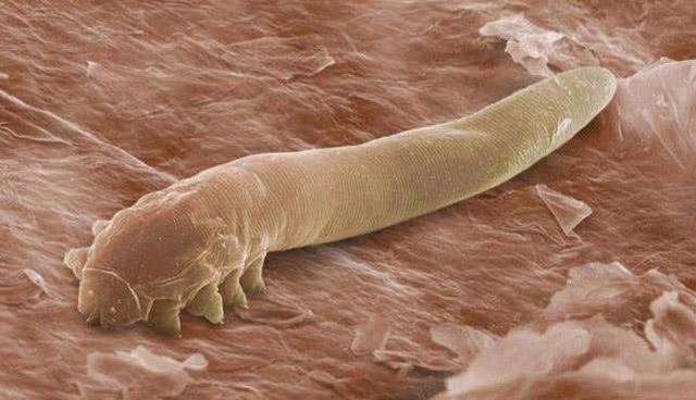 超棒国货去痘痘,祛除痘痘的国货测评