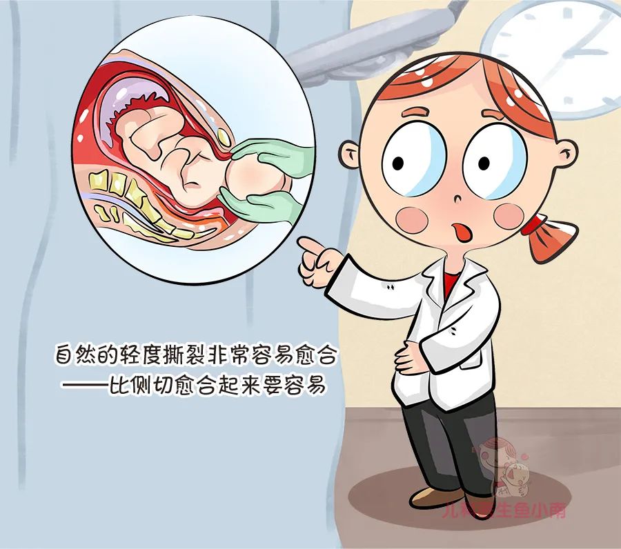 女人怕顺产侧切,为什么好多孕妇都害怕侧切