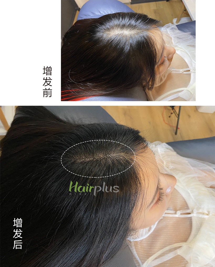 美丝珈增发,美丝珈增发能维持多久