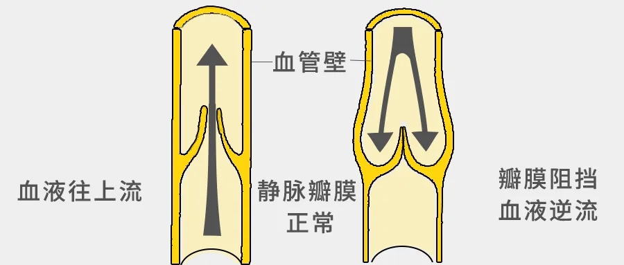 女子被鸡啄伤住进ICU,被鸡啄出血截肢